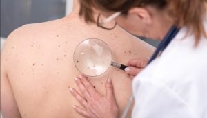 how window tinting can help reduce the risk of skin cancer